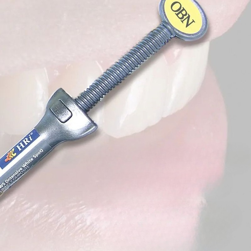 Diş Malzemeleri Meisu Estetik  - Uv Resin incelemesi ve fiyatı